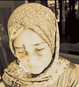 Polsek Cakung Telah Tetapkan Pelaku Penganiayaan Ibu Rumah Tangga Sebagai Tersangka
