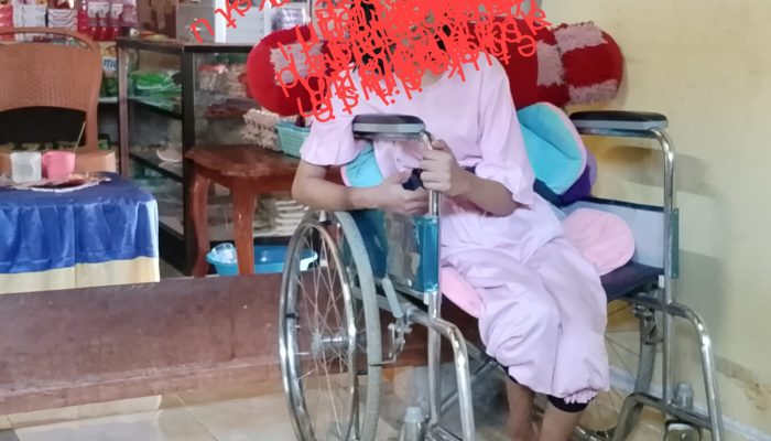 Dugaan Malpraktik Masa Lalu Mencuat: Kadis Kesehatan Tojo Una-Una Disorot Terkait Kondisi Anak yang Cacat Permanen