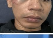 Korban Pengeroyokan di Tugu Selatan Koja Jakarta Utara