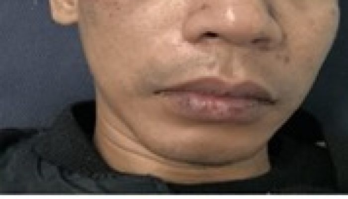 Korban Pengeroyokan di Tugu Selatan Koja Jakarta Utara